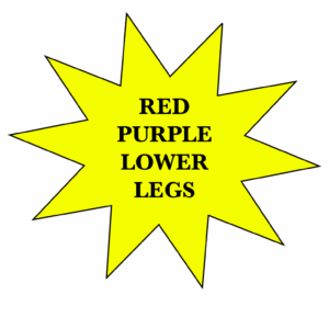 Red purple lower legs
