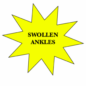 Swollen ankles