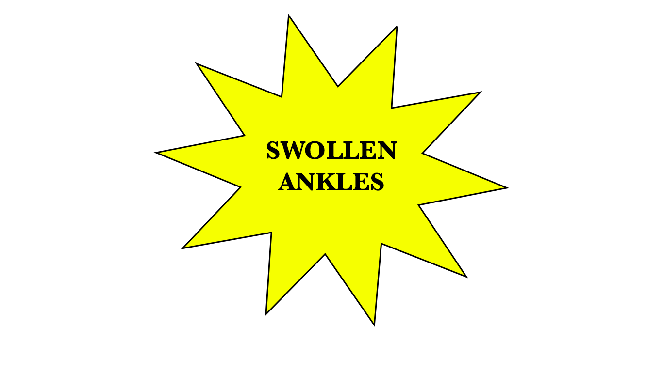 Swollen ankles